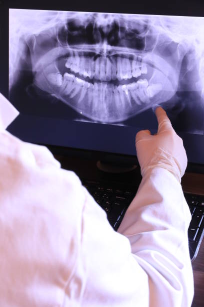 Best Emergency Dental Filling Replacement  in Bridgeport, IL
